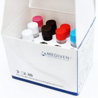 結核検査キット - GenoAmp® GRA2019 - Medical Innovation Ventures - 結核菌 / マイコバクテリア / 血液