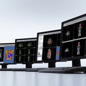 可視化ソフト - DICOM RT Studio - PTW Freiburg Physikalisch-Technische-Werkstätten - 処理 / 放射線治療用