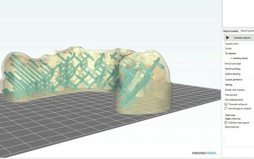 歯科用ソフト -  MicroForm® - Microlay - 3D ヴィジュアリゼーション / インポート / 3Dプリント