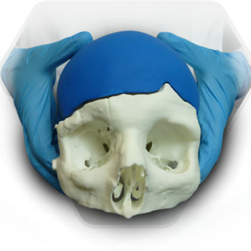 オーダーメイド頭蓋インプラント - SkullPT  - 3D Side