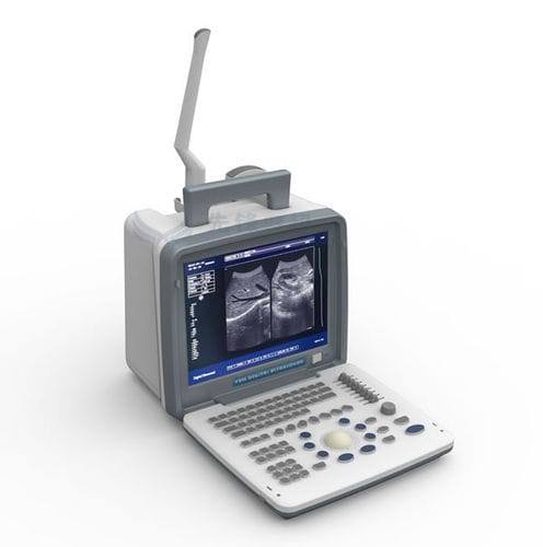 携帯型超音波装置 - XF300 - Xianfeng Ultrasound Medical - 多目的超音波画像診断用 / 白黒 / 内蔵コンソール
