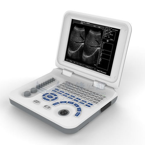 携帯型超音波装置 - XF30  - Xianfeng Ultrasound Medical - 多目的超音波画像診断用 / 白黒 / 10インチ