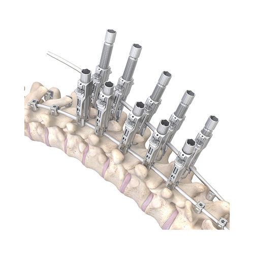 胸椎-腰椎骨接合システム - RESPONSE™ 5.5/6.0 - OrthoPediatrics - 後方進入 / 子供用