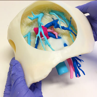 肝臓の解剖模型 - 3D Lifeprints UK Ltd - 動脈の / 静脈の