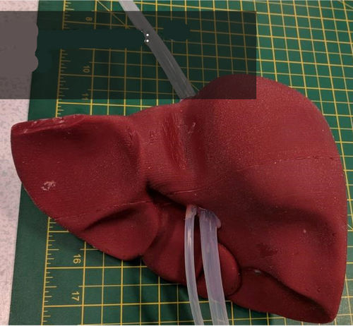 肝臓の解剖模型 - 3D Lifeprints UK Ltd - ロボット手術用 / 医療訓練用