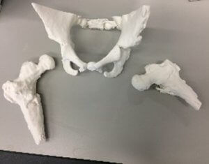 骨の解剖模型 - 3D Lifeprints UK Ltd - 骨盤の / 大腿骨の / 手術用