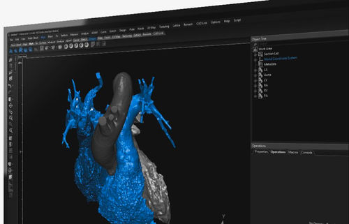 3D ヴィジュアリゼーションソフト - 3-matic  - Materialise UK - 医療用 / 解剖学 / デザイン