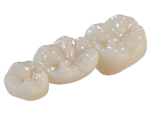 ジルコニア製歯科用ブリッジ - DIAMOND - Derby Dental - 奥歯 / 半透明