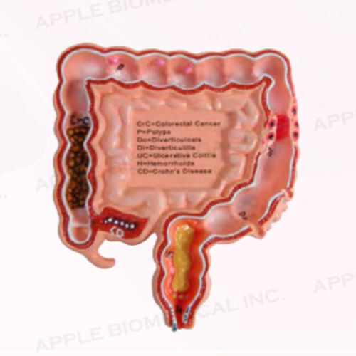結腸の解剖模型 - A345 - Apple Biomedical - 胃腸病学 / 実習用 / ピンク
