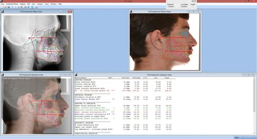 胎児頭蓋切開分析ソフト - Dr. Ceph - For Your Imaging Technologies - 医用画像用 / 歯列矯正 / 外科用