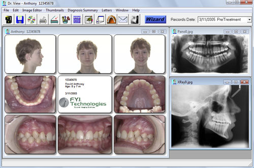 胎児頭蓋切開分析ソフト - Dr. View - For Your Imaging Technologies - 歯列矯正
