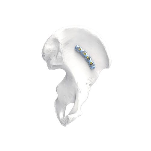 顔面骨格用圧迫プレート - PNM1075 - NORMMED Medical Devices - ロッキング / 金属製