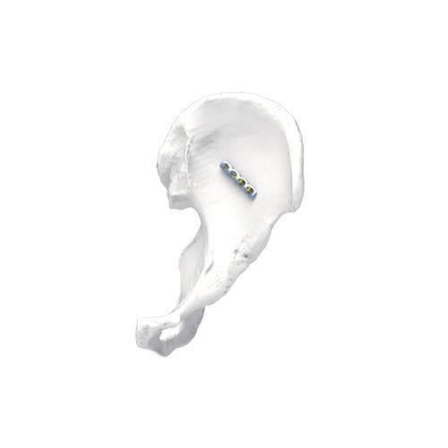 骨盤用圧迫プレート - PNM1009 - NORMMED Medical Devices - ロッキング / 金属製