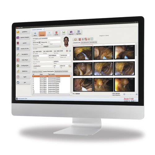 医療用ソフト - Zscan HD - Zscan software - 医用画像用 / 内視鏡用 / 耳鼻咽喉科用