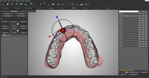 歯列矯正ソフト - O3D - Orchestrate Orthodontic Technologies - 制御 / 記録用 / デザイン