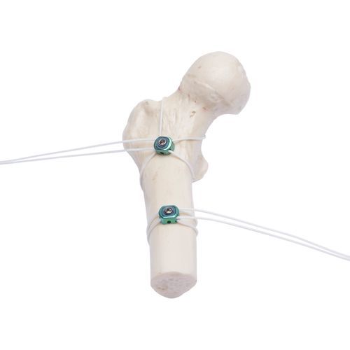 金属マルチフィラメント骨締結用ワイヤー - Aleda Medical