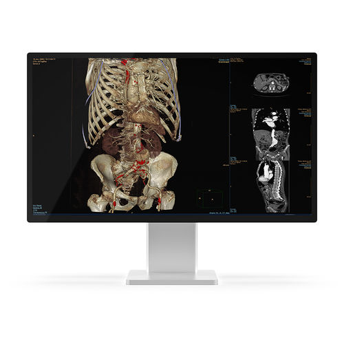医療用モニター - 27X4C-K1 - KTC Medical Solutions - 診断用 / 放射線科用 / QHD