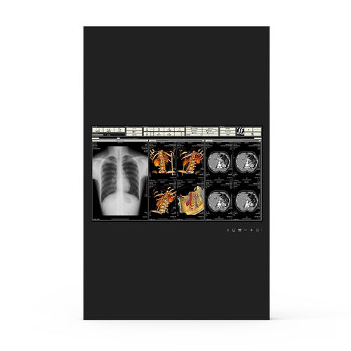 医療用モニター - 24H90 - KTC Medical Solutions - 手術室用 / 1920 x 1080 / 23.8インチ