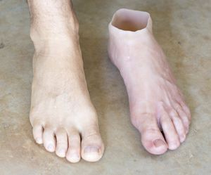 足用美容人口装具 - Northern Prosthetics - 大人用