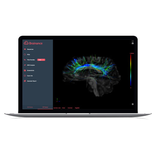 イメージ分析ソフト - Brainance MD  - Advantis Medical Imaging - リポーティング用 / 3D ヴィジュアリゼーション / DICOMビジュアリゼーション用