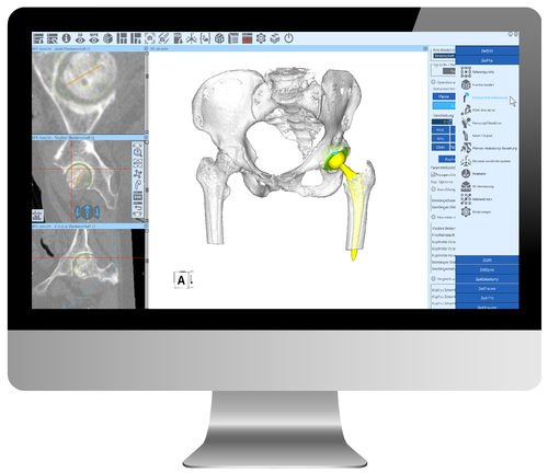 分析ソフト - ZedView - LEXI Co. - 計画用 / 処理 / インポート