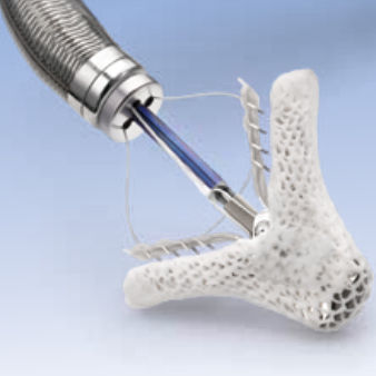 僧帽弁閉鎖不全の経皮治療用外科用クリップ - MitraClip&reg; - MitraClip