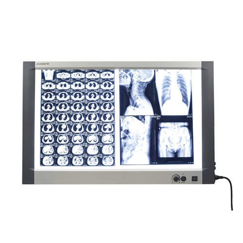 2面ネガトスコープ - MG-02X - Nanchang Micare Medical Equipment - 白色光 / スイッチ付 / マンモグラフィー用