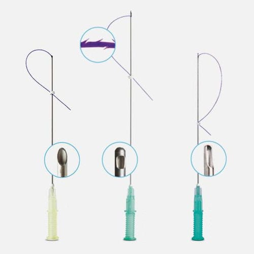 吸収性スレッドリフト - COG Pro series - W&O medical esthetics - ノッチ付き / スムース