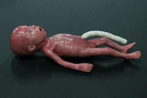 小児医療用訓練用マネキン - MICRO-PREEMIE - LifeCast Body Simulation Ltd - 気胸 / ベビー用 / シリコン