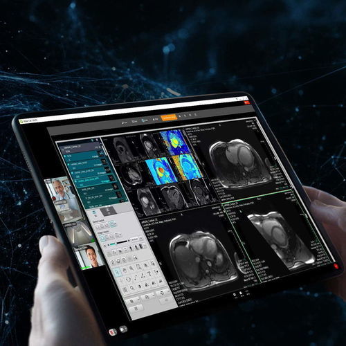 可視化コミュニケーションおよび管理システム - uOmniscan - Shanghai United Imaging - DICOMファイル用 / PACS（画像保管通信システム）用 / ビデオ