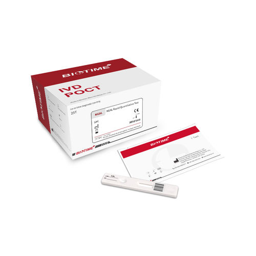 腎臓疾患検査キット - BIOT-YG-I, FLI-600 - Xiamen Biotime Biotechnology Co., Ltd. - 尿 / 免疫分析 / 蛍光線