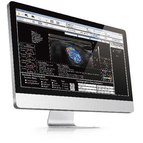 超音波画像診断用ソフト - AmCAD-UT® - AmCad BioMed - イメージ分析 / 管理用 / リポーティング用