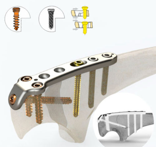 HEDGEHOG STUDIO] Machine Cut Aluminum Handle Knob Narrow