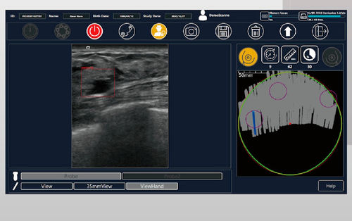超音波画像診断用ソフト - BR-FHUS Navigation™ - TaiHao Medical - ビューア / 診断用 / 乳がん検査用
