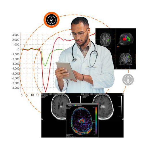 MRI用ソフト - SPHERE® 3.0 - Olea Medical - データ分析 / イメージ分析 / 画像強調