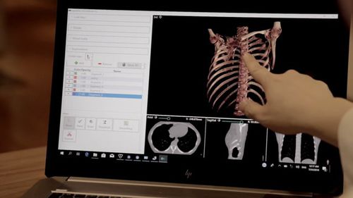 3D ヴィジュアリゼーションソフト - DigiTwin - Medical Augmented Intelligence (MAI) - 診断用 / 共有 / 処理