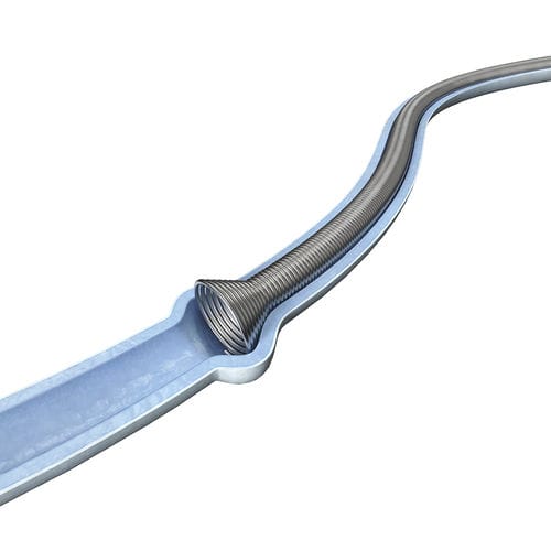 尿管ステント - SURSM series - Surgsci Medical - 金属製