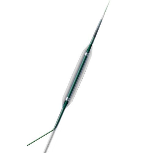 拡張カテーテル - Anchor™ SST - TT Medical - 冠動脈 / バルーン / ダブルルーメン