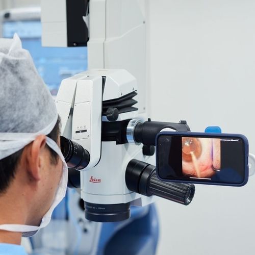 細隙灯用スマートフォン用アダプター - MicroREC  - Custom Surgical