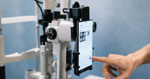 細隙灯用スマートフォン用アダプター - OPTIREC - Custom Surgical
