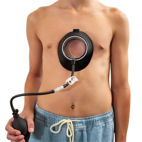 バキュームベル　漏斗胸 漏斗胸治療用バキュームベル - Gvacuum - Pectuslab Medical Devices