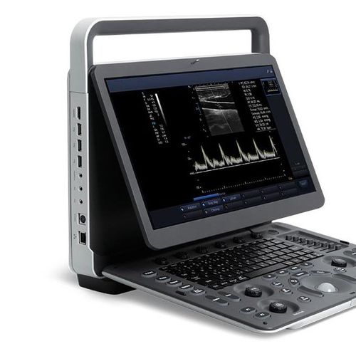 携帯型超音波装置 - E2 - Beijing iTrason Technologies - 多目的超音波画像診断用 / 婦人・産科超音画像診断用 / 腹部・骨盤超音画像診断用