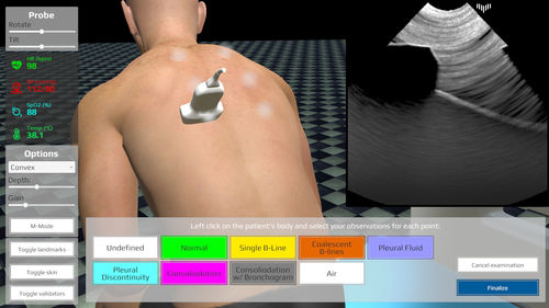 超音波画像診断用患者シミュレーター - LUS - Medical Simulation Technologies - 看護用 / 救急医療用 / 集中治療用