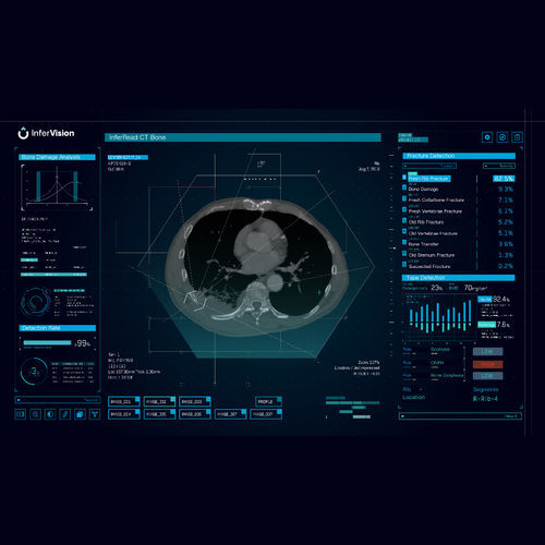 分析ソフト - Bone - Beijing Infervision Technology Co. Ltd. - イメージ分析 / 検出用 / 医療用