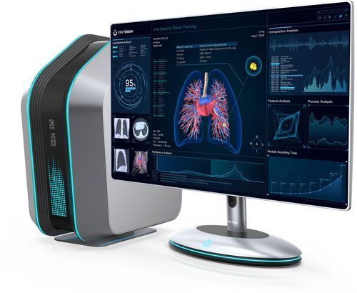 医療用ソフト - InferOperate® - Beijing Infervision Technology Co. Ltd. - 手術用 / 外科用 / 診療所用