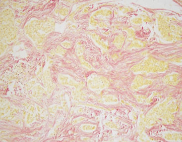 染色液試薬キット - Van Gieson - Celnovte Biotechnology Co., Ltd. - 組織学用