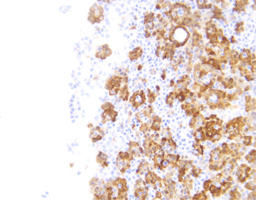 モノクローナル抗体試薬 - CCM-0222 - Celnovte Biotechnology Co., Ltd. - ポリクローナル抗体 / 研究用 / 組織用