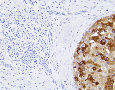 モノクローナル抗体試薬 - CMM-0112 - Celnovte Biotechnology Co., Ltd. - ポリクローナル抗体 / 研究用 / 組織用