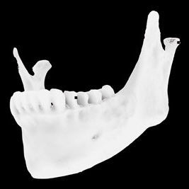 骨の解剖模型 - Osteophoenix - 下顎骨 / 口腔外科用