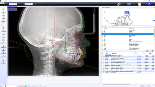 歯科矯正用ソフト - OrthoTP - Microlab - 分析